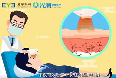 愛(ài)爾眼科干眼癥全系診療服務(wù),量“眼”打造個(gè)性化治療方案